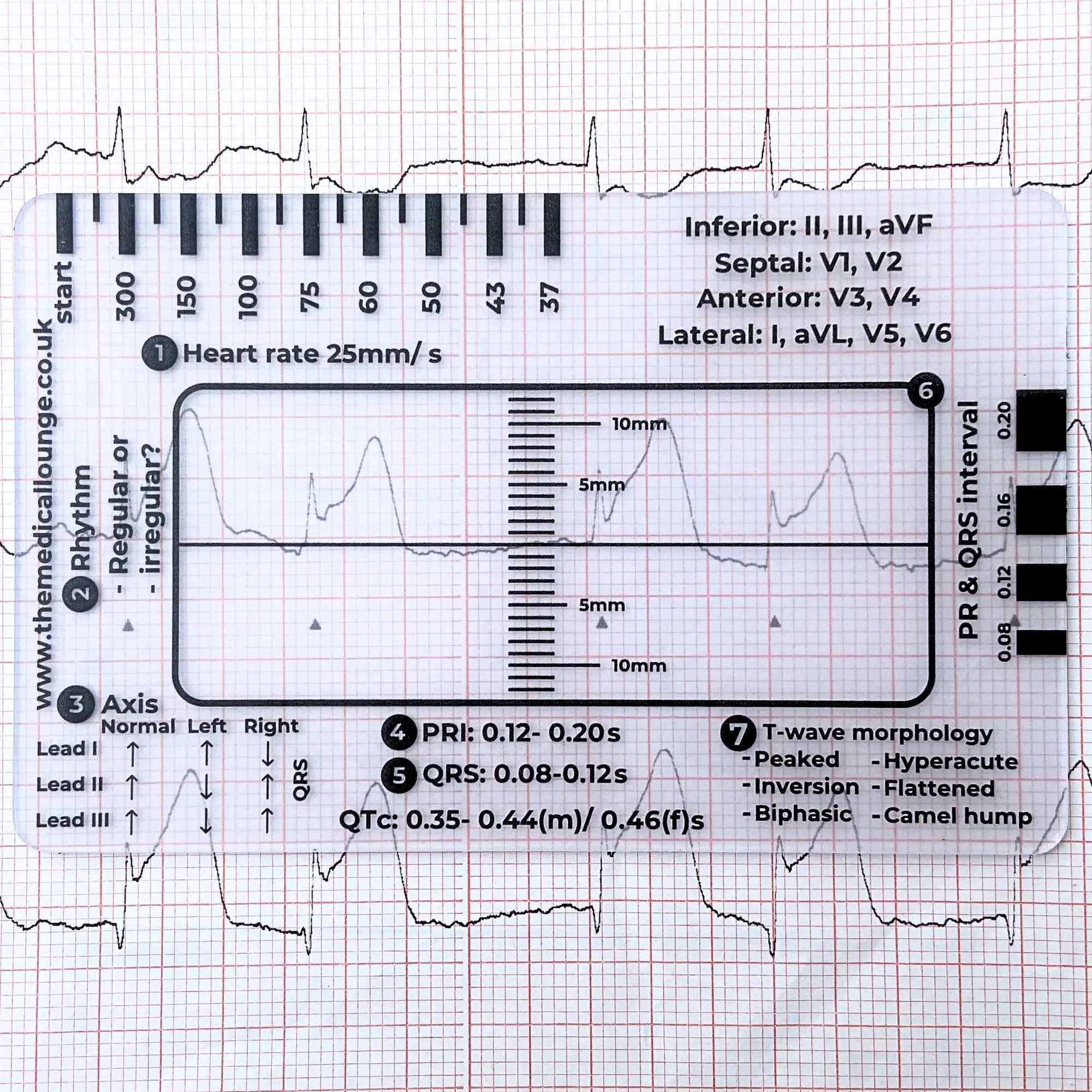 ECG ruler