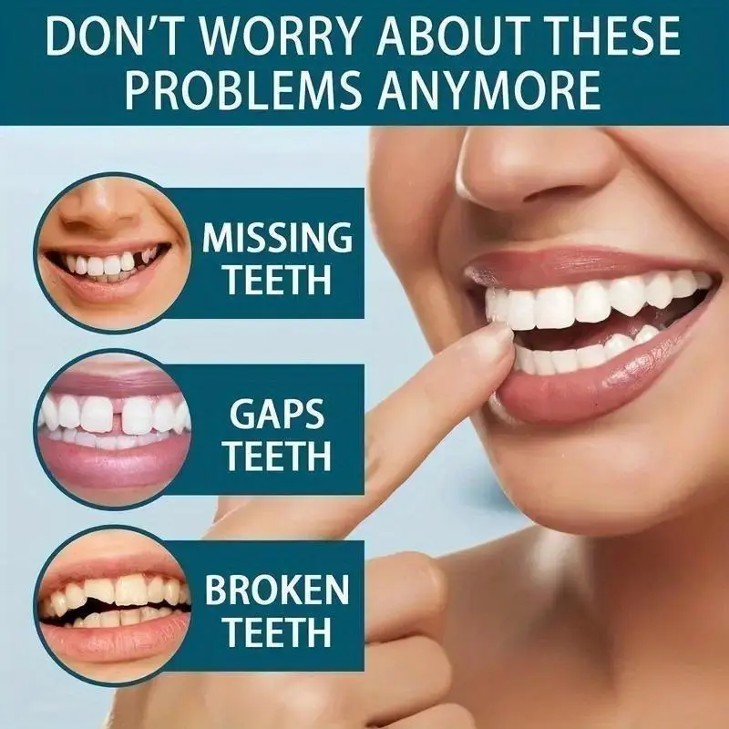 2pcs Comfortable And Flexible White Denture Veneers With Upper And Lower Denture Accessories, Unisex, Easy-to-Wear Dental Accessories - The Ultimate Denture Veneer Solution To Boost Your Confidence Oral 2