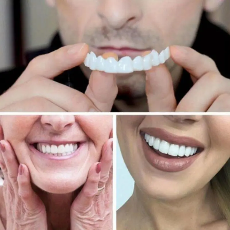 2pcs Comfortable And Flexible White Denture Veneers With Upper And Lower Denture Accessories, Unisex, Easy-to-Wear Dental Accessories - The Ultimate Denture Veneer Solution To Boost Your Confidence Oral 1