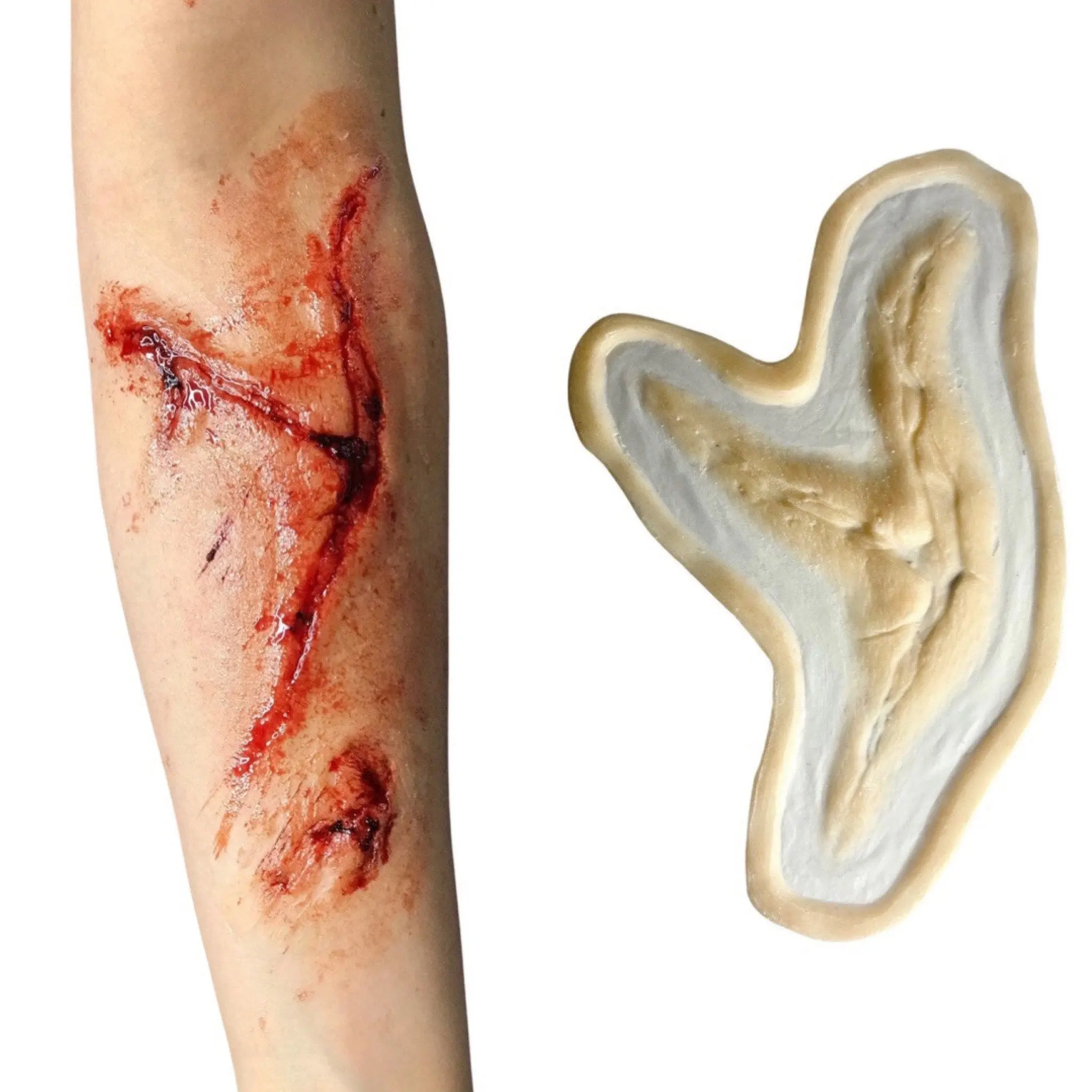 Laceration Wound