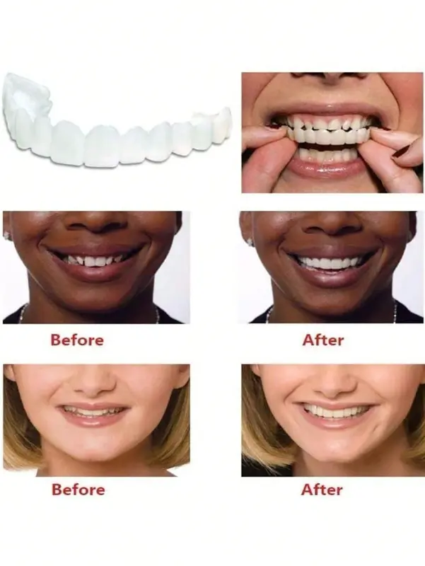 2pcs Fake Cosmetic Teeth (1 Top + 1 Bottom) for Confidence Boost - Perfect for Business Meetings & Charming Smile 1