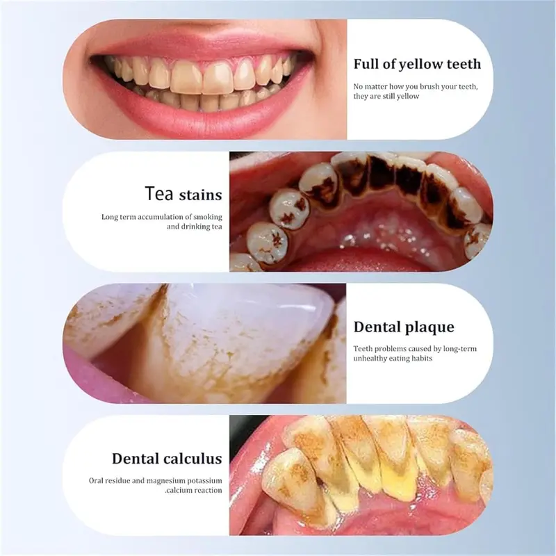 【UK SELLER 】Electric Tooth Cleaning Instrument, 5 Modes Cordless Teeth Cleaner & Waterproof Oral Irrigator Combo, Protect Dental Health Mother's Day and Father's Day gifts 3