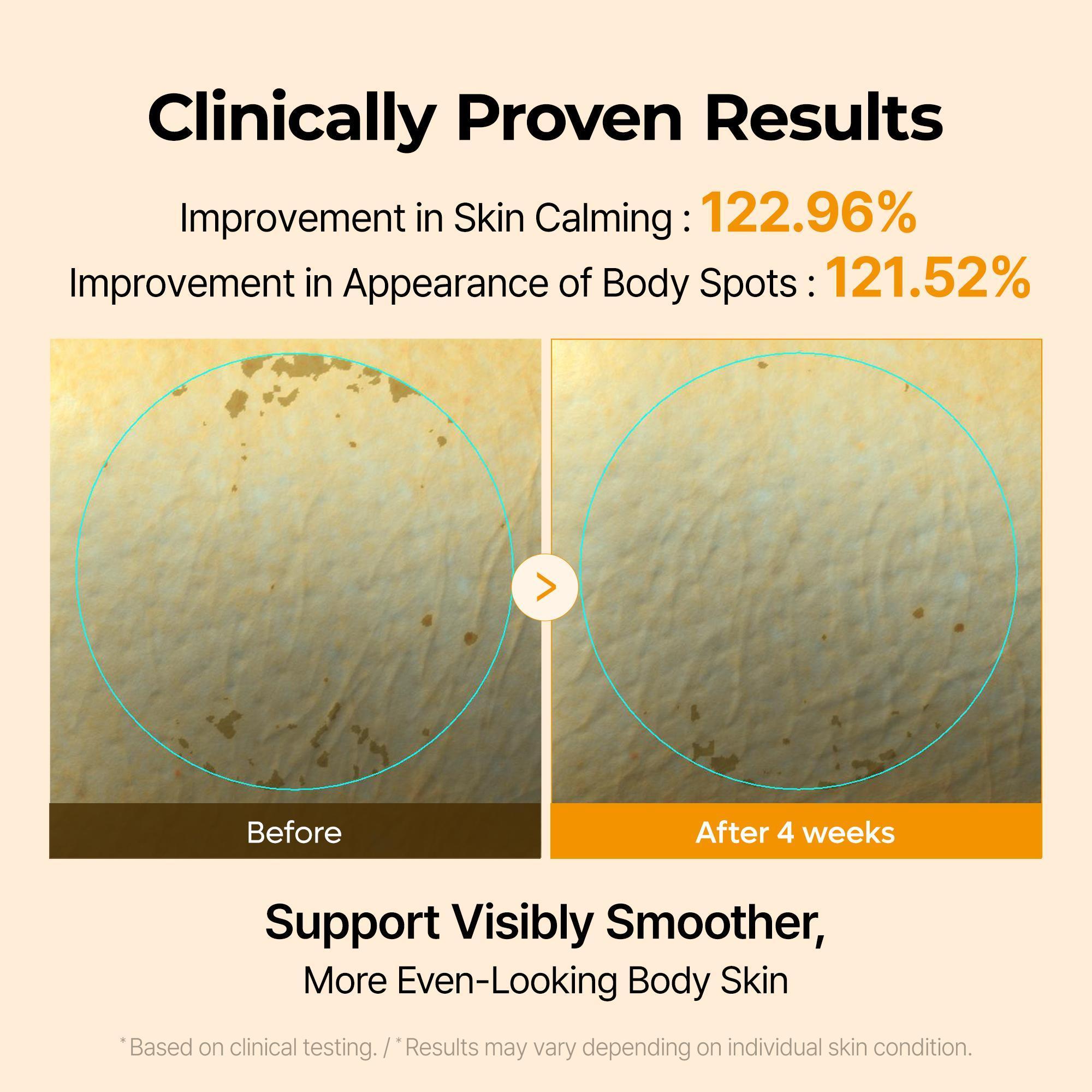 [Dr.Melaxin Official] Complete Brightening Routine | Peel Shot Serum, TX Body Peeling Shot, Kojic Acid Turmeric Capsule Body Cream & Kojic Acid Turmeric Serum Soap 4-Piece Set