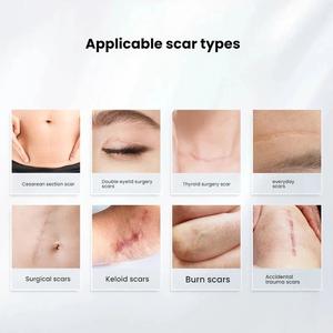 Silicone Scar Gel - Acne Scar, Burn, C-Section & Stretch Mark