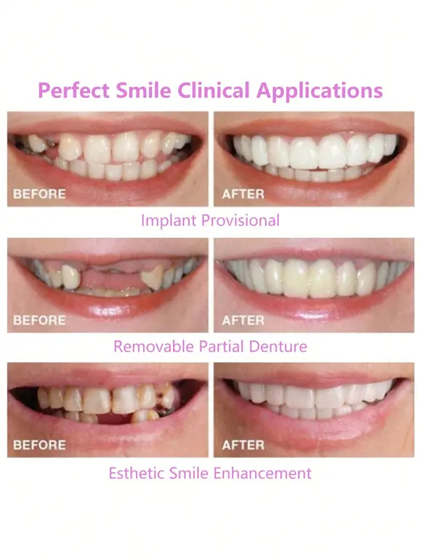 2pcs Fake Cosmetic Teeth (1 Top + 1 Bottom) for Confidence Boost - Perfect for Business Meetings & Charming Smile 3