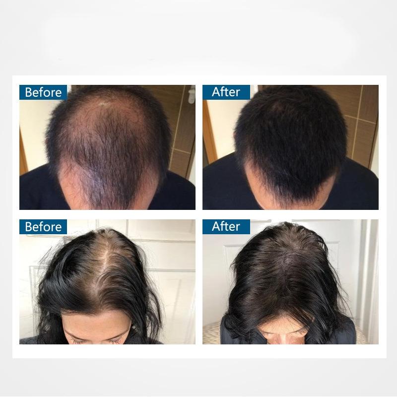 Hair Building Fibers with Spray Applicator – Instant Hair Thickening Solution 6