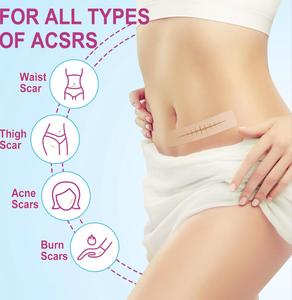 Silicone Scar Sheets,1 Box Multi-purposeScar Patches, Smoothing Skin CarePatches, Easy To Use, Suitable for All SkinTypes