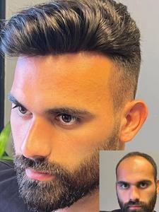 Men's Hair Piece, Natural Looking Human Hair Topper for Men, Breathable Comfortable Hair Piece for Daily Use