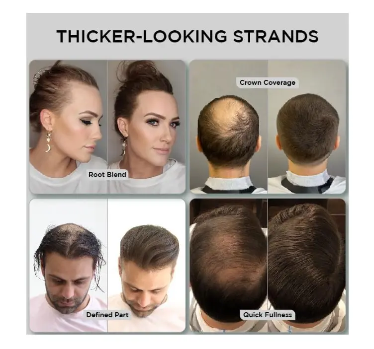THICK FIBER Hair Fibres (Pack of 1 DARK BROWN) | Hair Powder for Thinning Hair 25g Bottle | Makes Thin Hair Look Thicker in Seconds | Hair Loss Concealer For Women & Men 2