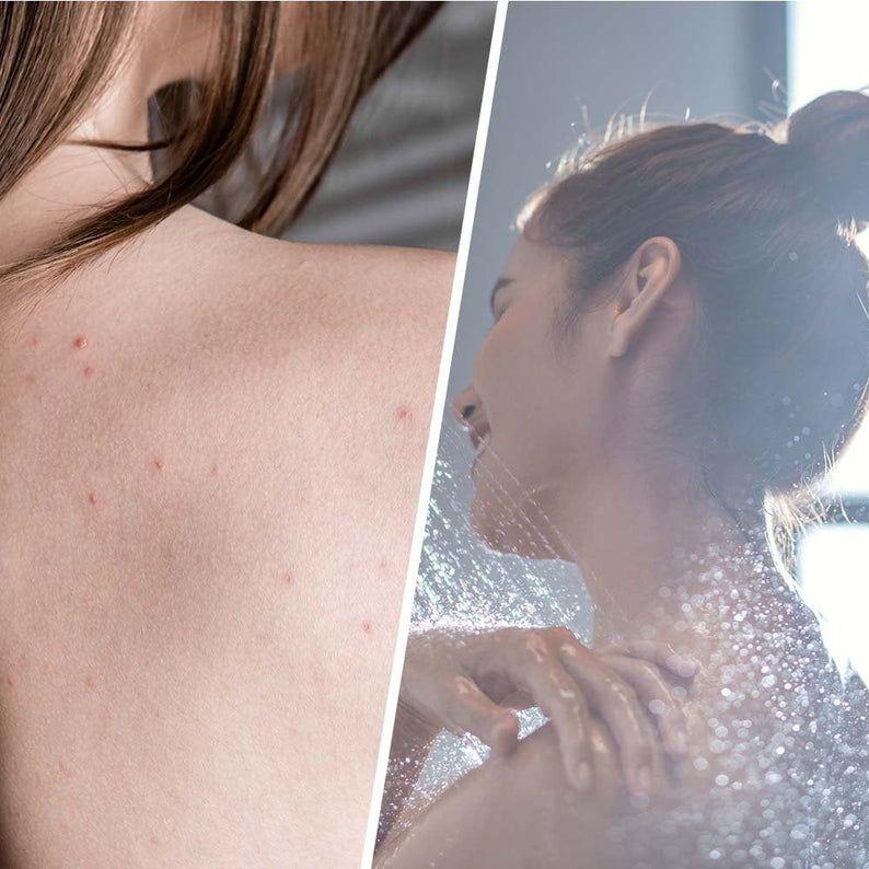 Product Introduction of Biovene Salicylic Blemish Scrub Body Exfoliator 250ml 8